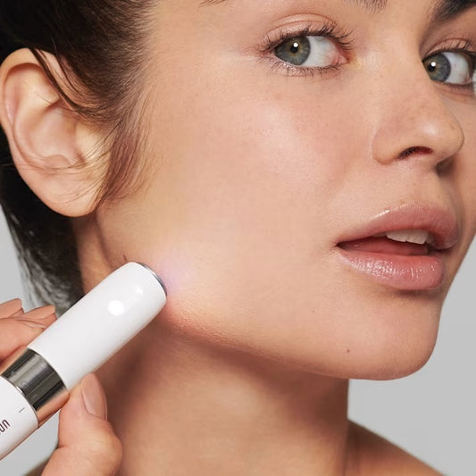 Electric Acne Spot Treatment Pen – Blue Light Therapy Device
